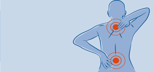 Blaue Zeichnung eines menschlichen Oberkörpers mit roten Schmerzpunkten auf der Wirbelsäule